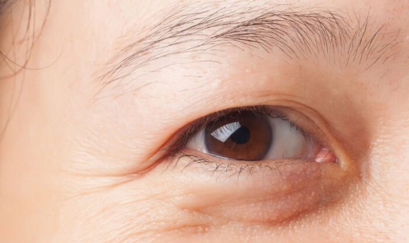 dấu hiệu bệnh lao mắt