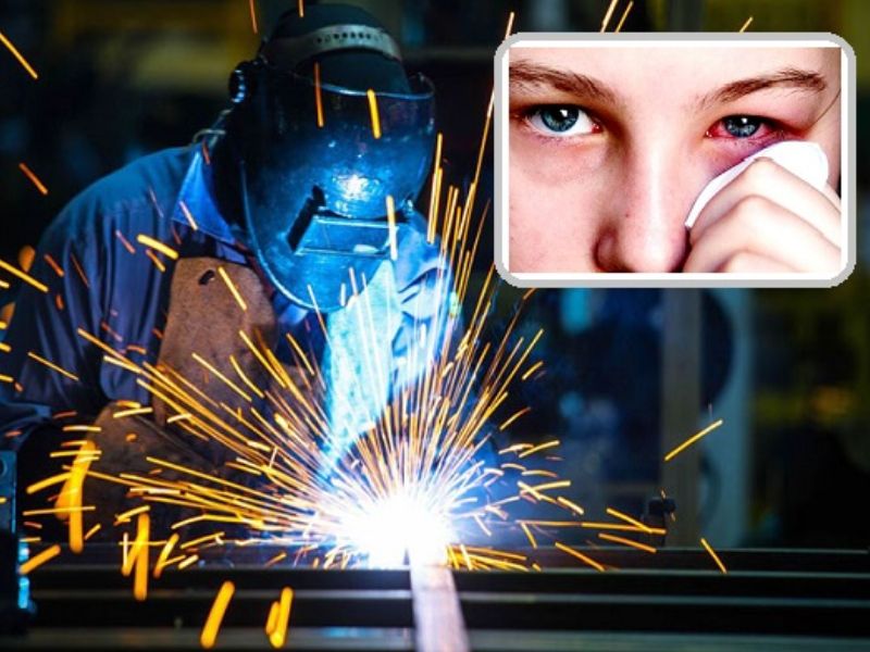 Hàn bị đau mắt không lây nhưng làm suy giảm sức đề kháng của mắt