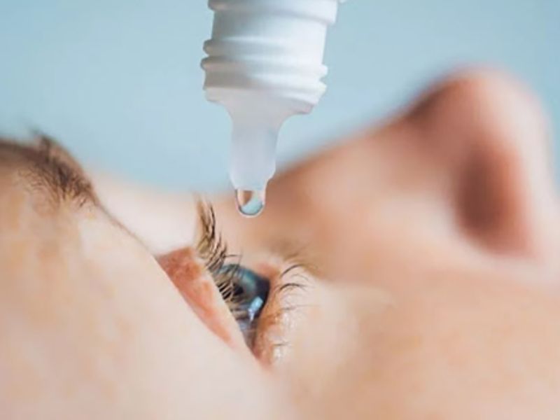 Rửa mắt bằng thuốc nhỏ mắt là cách chữa cộm mắt đơn giản nhưng hiệu quả