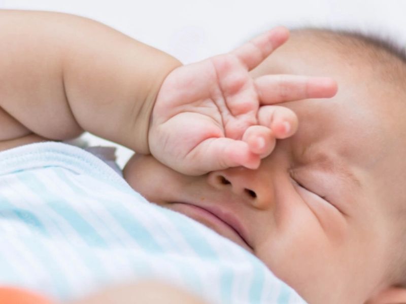 Tăng nhãn áp bẩm sinh là dạng bệnh hiếm gặp ở trẻ em